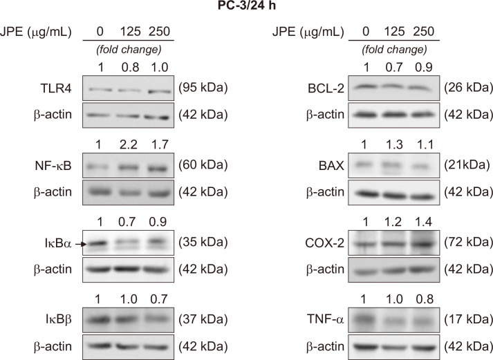 Brazilian Berry Extract Differentially Induces Inflammatory and Immune Responses in Androgen Dependent and Independent Prostate Cancer Cells.