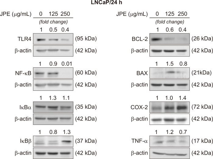 Brazilian Berry Extract Differentially Induces Inflammatory and Immune Responses in Androgen Dependent and Independent Prostate Cancer Cells.