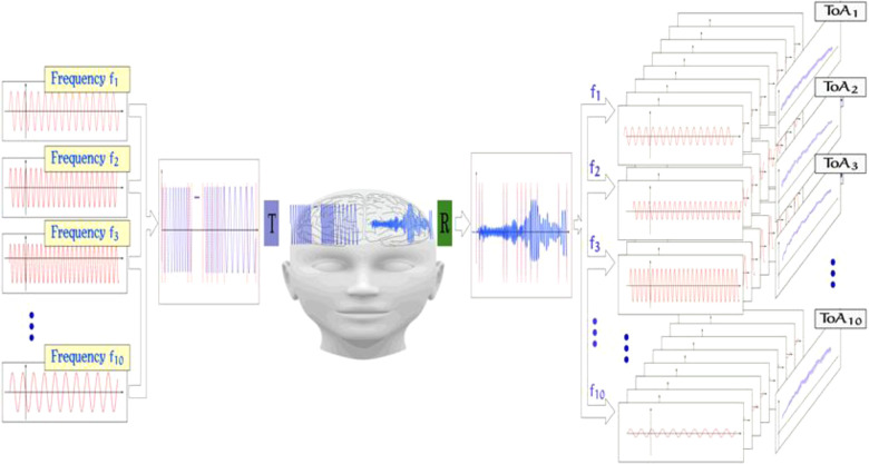 Acoustocerebrography in septic patients: A randomized and controlled pilot study.