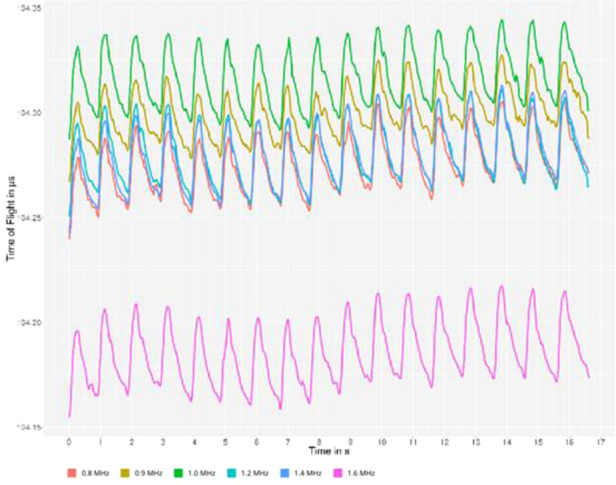 Acoustocerebrography in septic patients: A randomized and controlled pilot study.