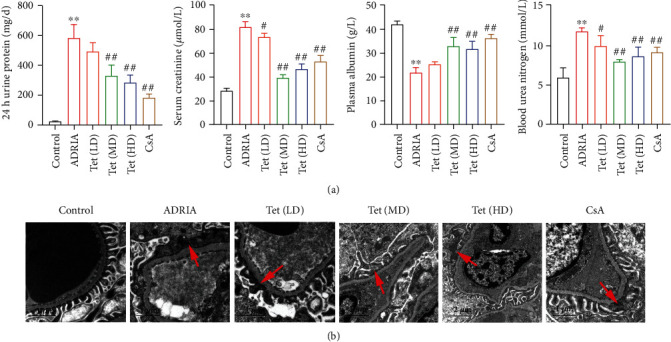 Tetrandrine Attenuates Podocyte Injury by Inhibiting TRPC6-Mediated RhoA/ROCK1 Pathway.