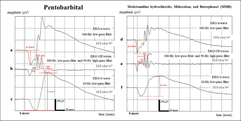 Differences in the Effects of Pentobarbital Anesthetic and Combination of Medetomidine Hydrochloride, Midazolam, and Butorphanol Tartrate Anesthetic on Electroretinogram in Spontaneously Diabetic Torii Fatty Rats.