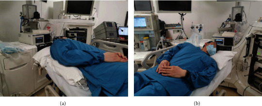 Safety and Efficacy of the Supine Position with the Right Shoulder Raised versus the Left Lateral Position in Peroral Endoscopic Myotomy for Achalasia: A Large-Sample Retrospective Study.