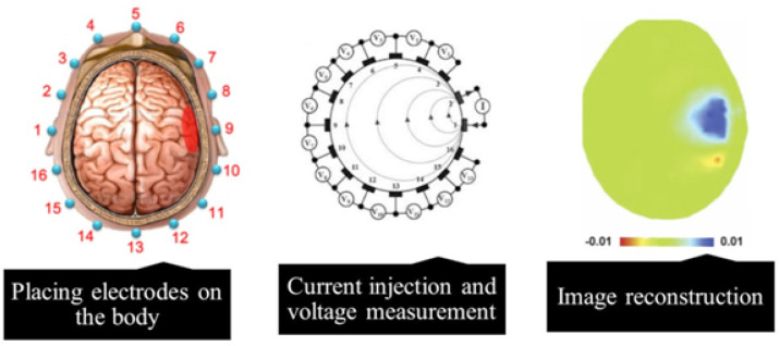 Applications of Electrical Impedance Tomography in Neurology.