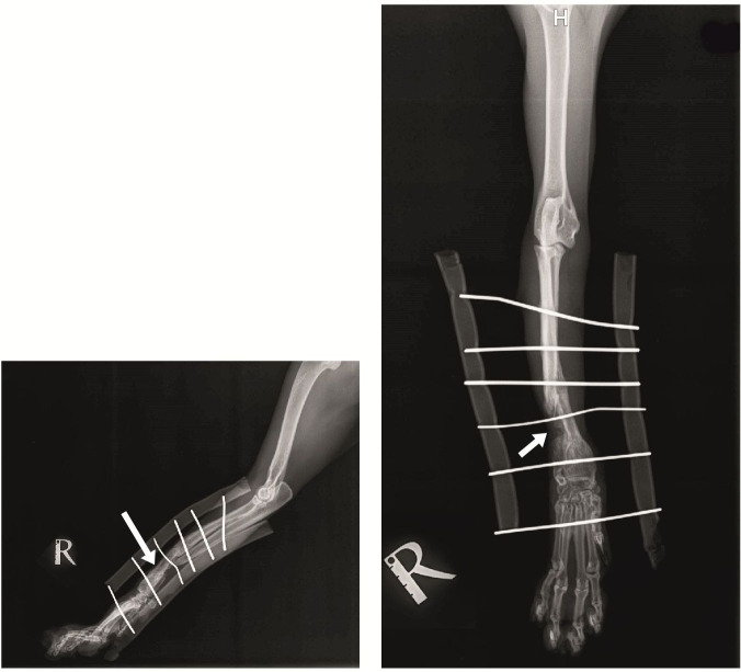 Successful outcome of distal radius non-union after open fracture osteomyelitis treated by external fixation and bone grafting in a cat: case report.