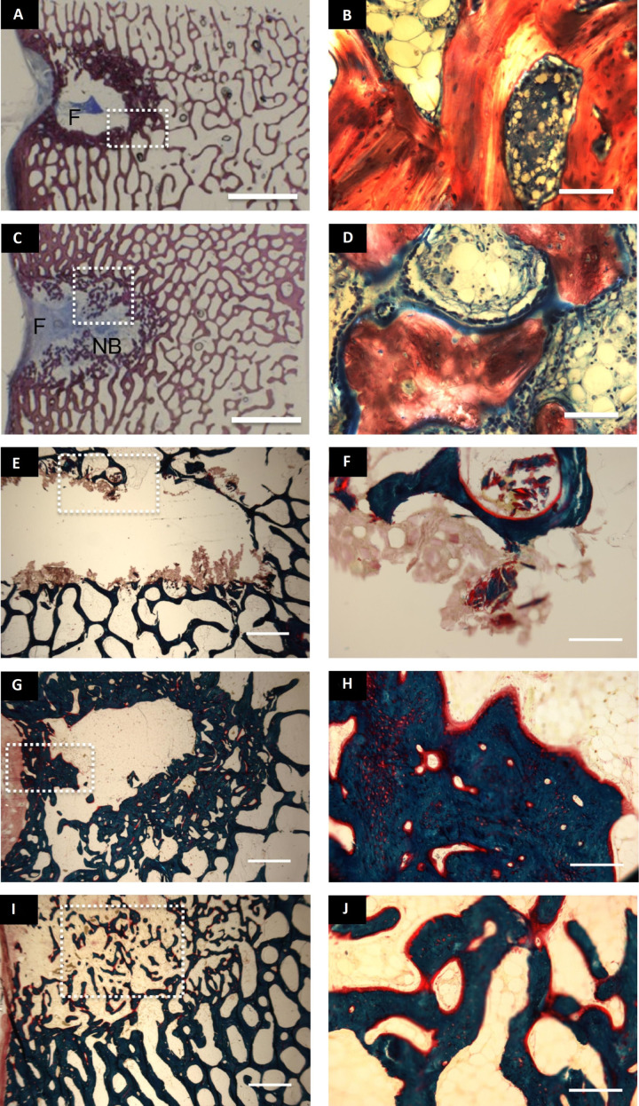 Preclinical safety study of nacre powder in an intraosseous sheep model.