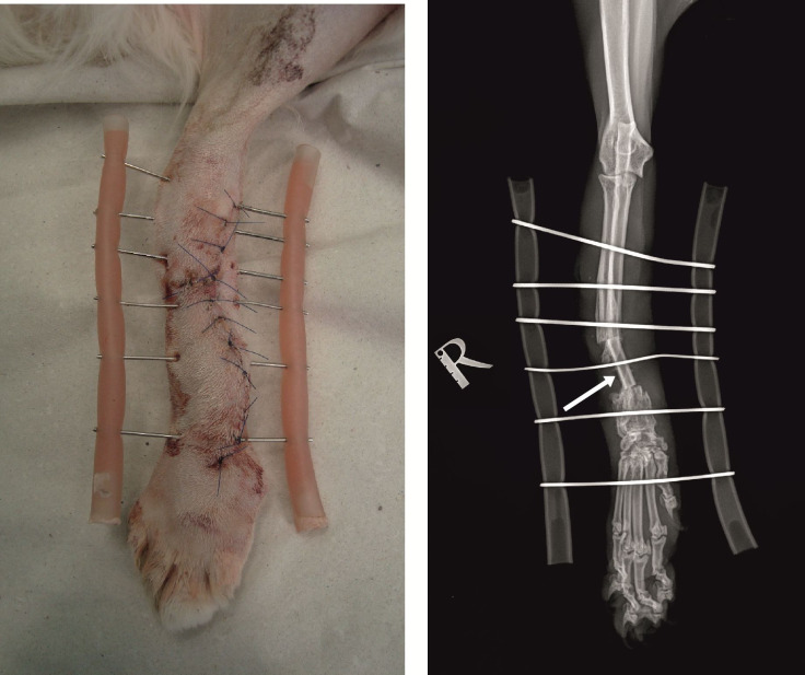 Successful outcome of distal radius non-union after open fracture osteomyelitis treated by external fixation and bone grafting in a cat: case report.