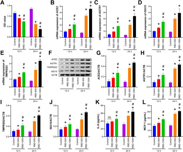 Effects of growth hormone/estrogen/androgen on COVID-19-type proinflammatory responses in normal human lung epithelial BEAS-2B cells.