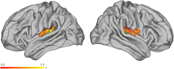 Supramodal Sentence Processing in the Human Brain: fMRI Evidence for the Influence of Syntactic Complexity in More Than 200 Participants.