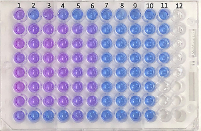 Irrigation Solutions Negatively Affect the Viability and Function of Human Fibroblasts: An in vitro Study.