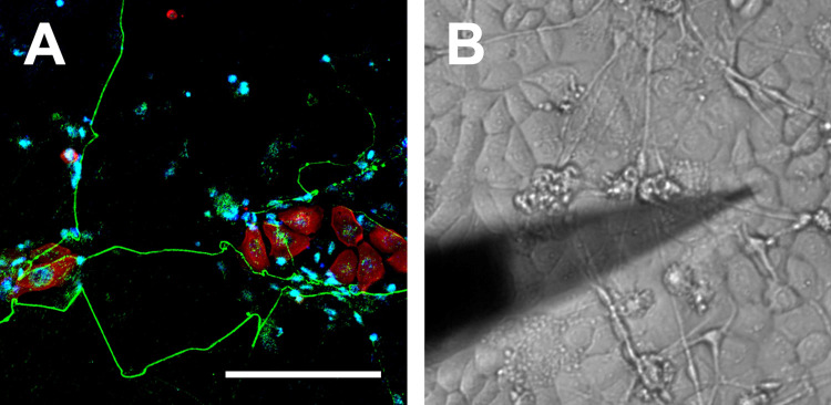 Influence of gap junctions upon Ca<sup>2+</sup> propagation from stimulated keratinocytes to DRG neurons.