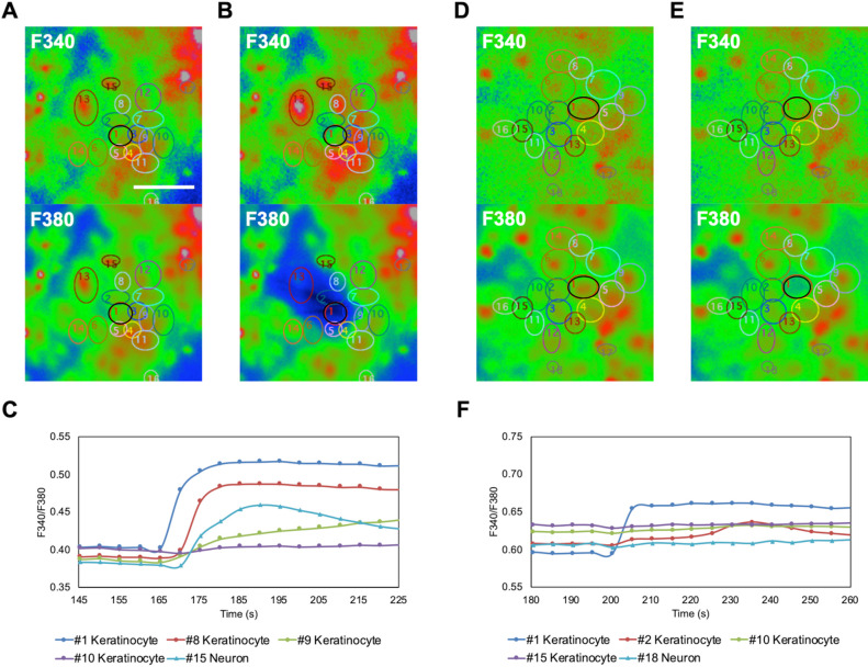 Influence of gap junctions upon Ca<sup>2+</sup> propagation from stimulated keratinocytes to DRG neurons.