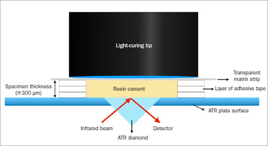 Polymerization Kinetics, Shrinkage Stress, and Bond Strength to Dentin of Conventional and Self-adhesive Resin Cements.
