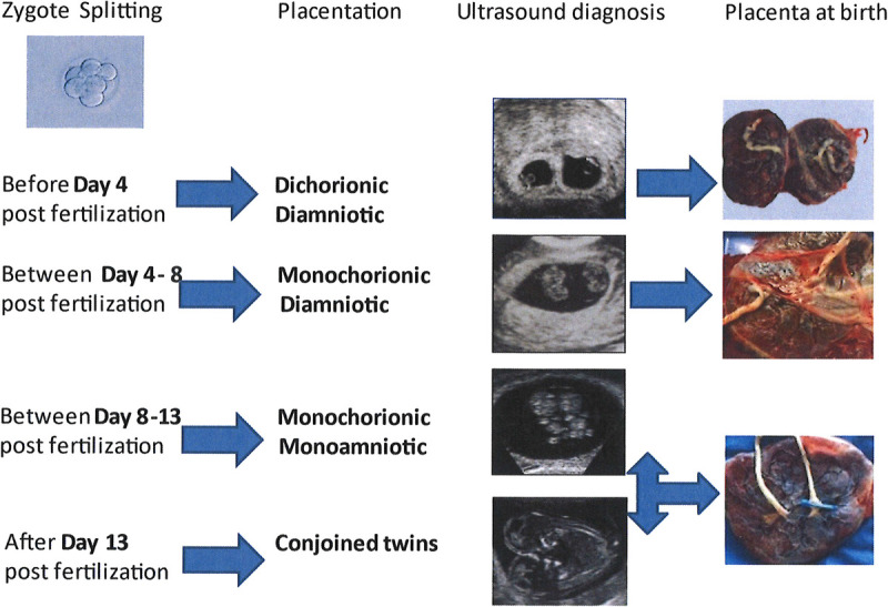 The Umbilical Cord and Complications of Twin Gestations.
