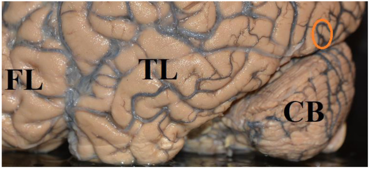 A Scientific Approach to Conscious Experience, Introspection, and Unconscious Processing: Vision and Blindsight.