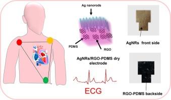 Implementation of hybrid Ag nanorods embedded RGO-PDMS conductive material for flexible and dry electrocardiography sensor