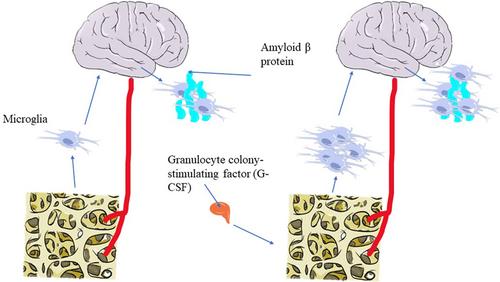 Advances in the study of the relationship between Alzheimer's disease and the gastrointestinal microbiome