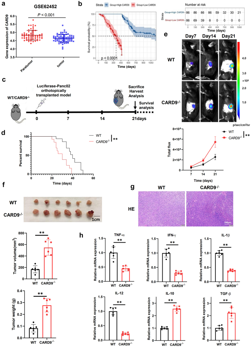 CARD9 deficiency promotes pancreatic cancer growth by blocking dendritic cell maturation via SLC6A8-mediated creatine transport.