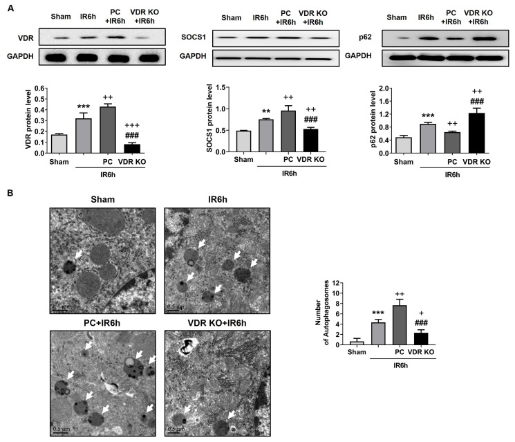 Vitamin D receptor mediates liver ischemia and reperfusion injury by autophagy-regulated M2 macrophage polarization.