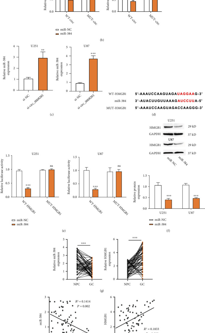 circ_0008285 Regulates Glioma Progression via the miR-384/HMGB1 Axis.