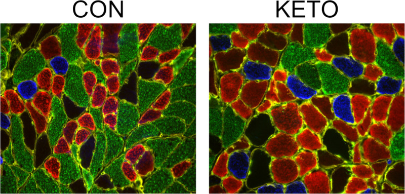 Ketogenic Diets and Mitochondrial Function: Benefits for Aging But Not for Athletes.