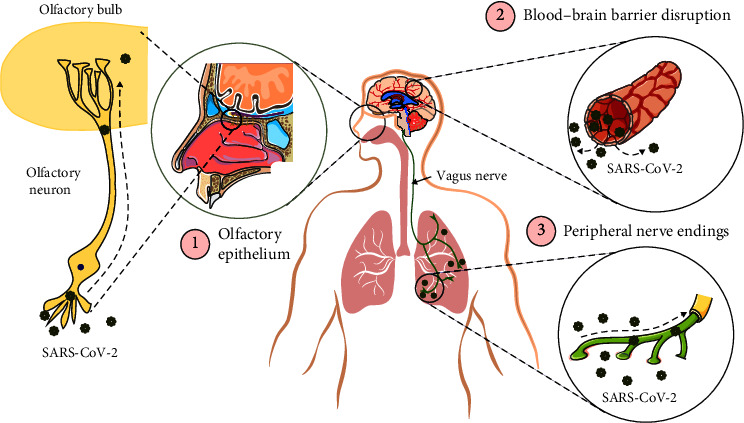 Brain Renin-Angiotensin System: From Physiology to Pathology in Neuronal Complications Induced by SARS-CoV-2.