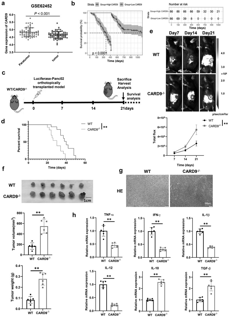 CARD9 deficiency promotes pancreatic cancer growth by blocking dendritic cell maturation via SLC6A8-mediated creatine transport.