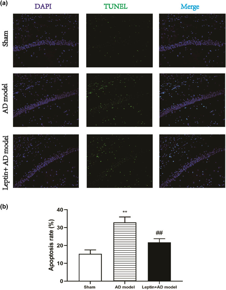 Leptin ameliorates Aβ1-42-induced Alzheimer's disease by suppressing inflammation via activating p-Akt signaling pathway.