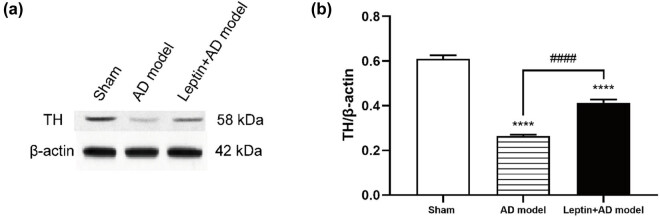 Leptin ameliorates Aβ1-42-induced Alzheimer's disease by suppressing inflammation via activating p-Akt signaling pathway.