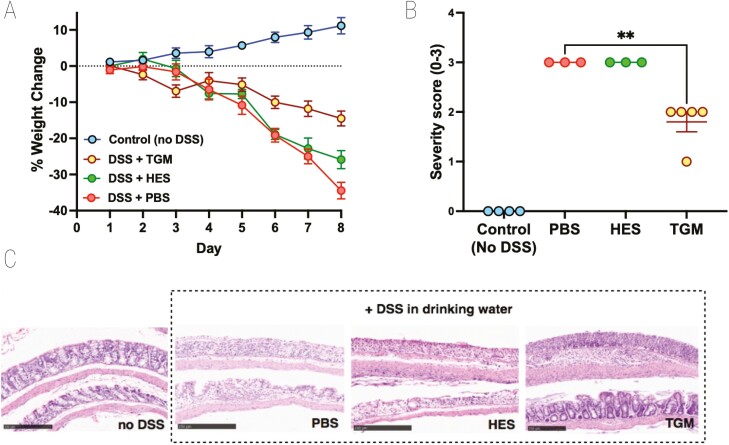 Protection from T cell-dependent colitis by the helminth-derived immunomodulatory mimic of transforming growth factor-β, <i>Hp</i>-TGM.