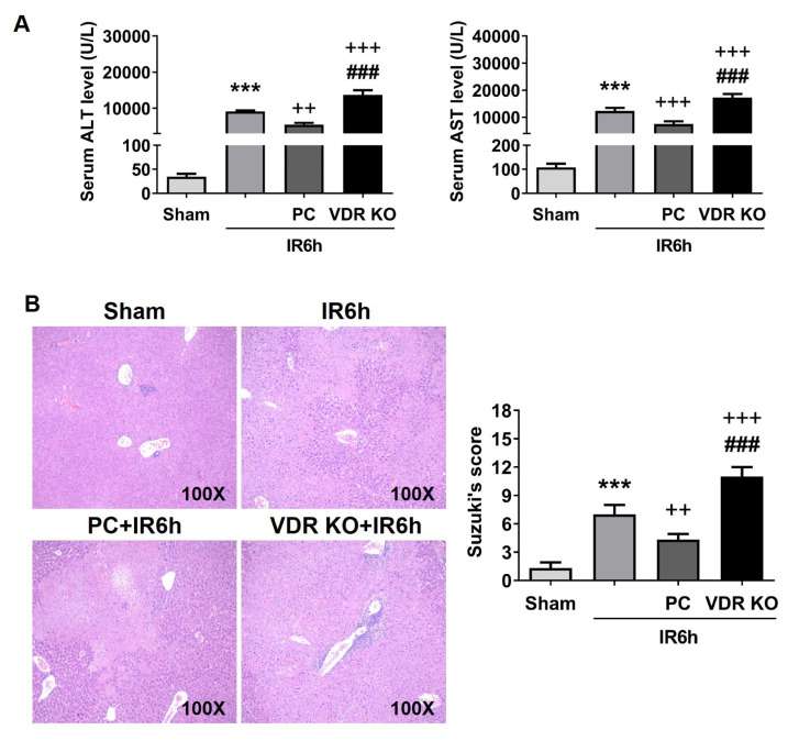 Vitamin D receptor mediates liver ischemia and reperfusion injury by autophagy-regulated M2 macrophage polarization.