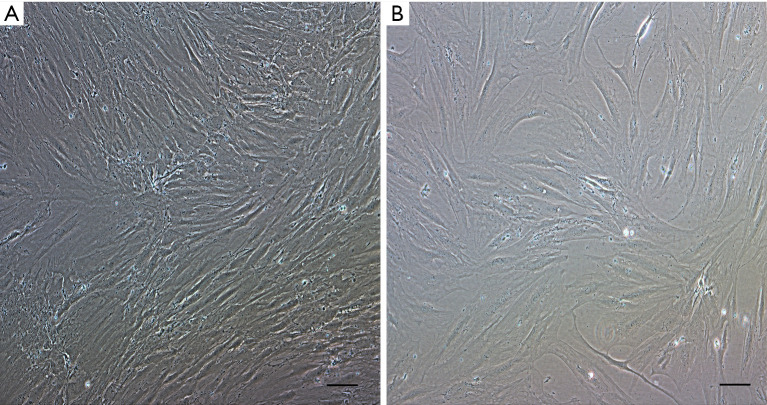 Femur bone marrow from brain death deceased donors as source of human mesenchymal stromal cells for cell therapy.