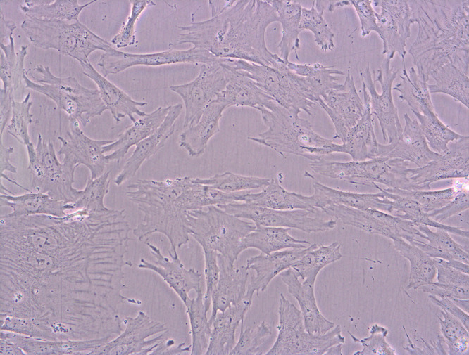 VEGF Expression in Umbilical Cord MSC Depends on the Patient's Health, the Week of Pregnancy in Which the Delivery Took Place, and the Body Weight of the Newborn - Preliminary Report.