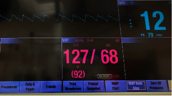 Anesthetic Management of a Pediatric Patient with Congenital Methemoglobinemia.