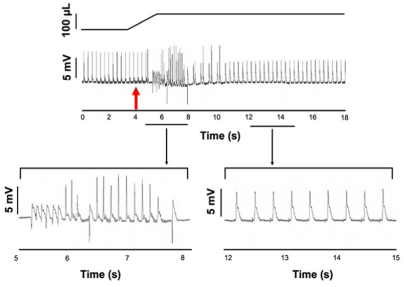 Endocardial role in arrhythmias induced by acute ventricular stretch and the involvement of Purkinje fibres, in isolated rat hearts