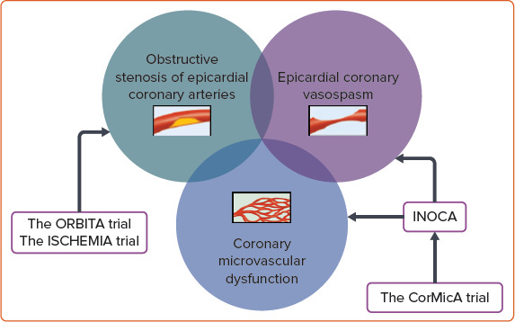 Coronary Microvascular Spasm: Clinical Presentation and Diagnosis.