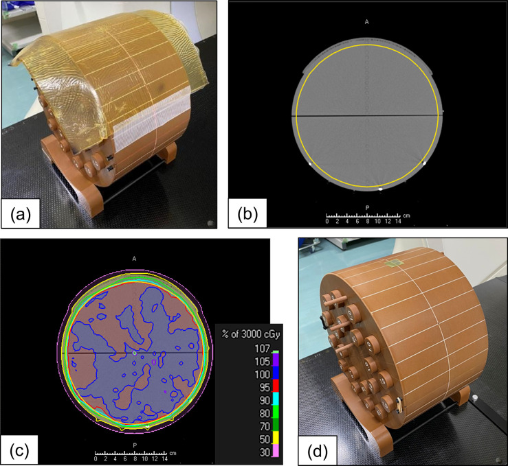 Dosimetric investigation of whole-brain radiotherapy with helical intensity modulated radiation therapy and volumetric modulated arc therapy for scalp sparing.