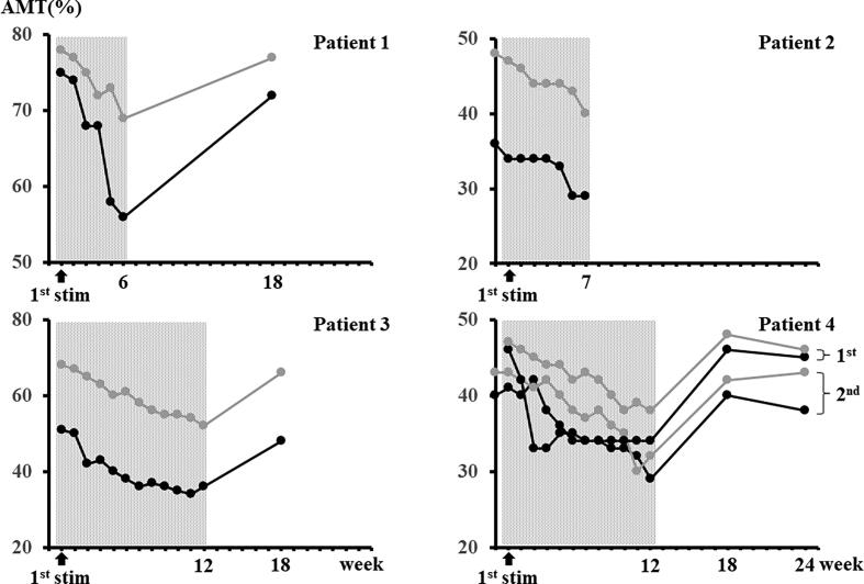 Quadripulse transcranial magnetic stimulation inducing long-term depression in healthy subjects may increase seizure risk in some patients with intractable epilepsy