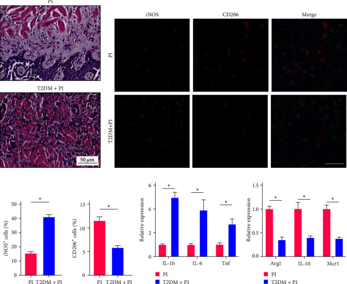 Abnormal Decrease of Macrophage ALKBH5 Expression Causes Abnormal Polarization and Inhibits Osteoblast Differentiation.