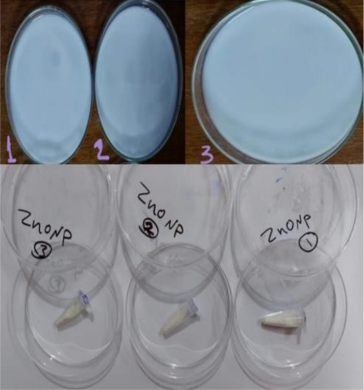 Study of the antibacterial effects of the starch-based zinc oxide nanoparticles on methicillin resistance <i>Staphylococcus aureus</i> isolates from different clinical specimens of patients from Basrah, Iraq.