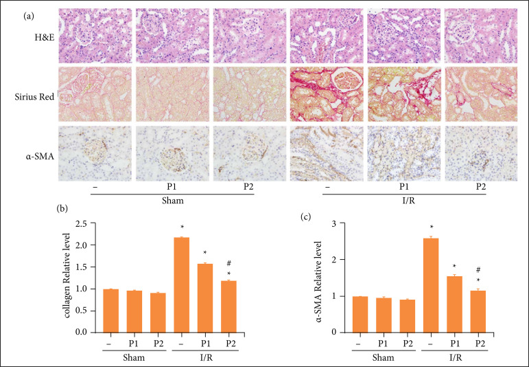 Puerarin alleviated oxidative stress and ferroptosis during renal fibrosis induced by ischemia/reperfusion injury via TLR4/Nox4 pathway in rats.