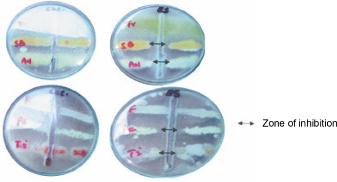 Antimicrobial activities and phylogenetic study of <i>Erythrina senegalensis</i> DC (Fabaceae) seed lectin.