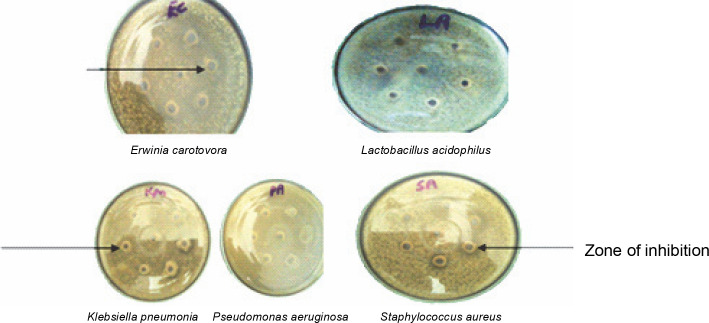 Antimicrobial activities and phylogenetic study of <i>Erythrina senegalensis</i> DC (Fabaceae) seed lectin.