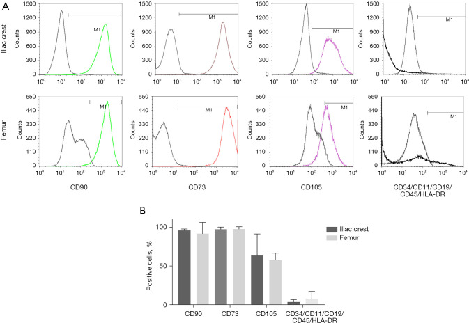 Femur bone marrow from brain death deceased donors as source of human mesenchymal stromal cells for cell therapy.