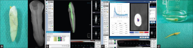 Mandibular Teeth as Predictors in Forensic Age Estimation: A Cone-Beam Computed Tomography-Based Pulp Volume Regression Study.