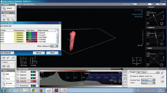 Mandibular Teeth as Predictors in Forensic Age Estimation: A Cone-Beam Computed Tomography-Based Pulp Volume Regression Study.