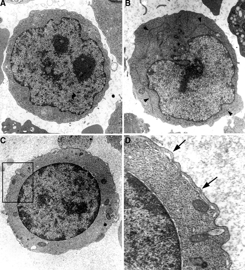 Ultrastructural characteristics of erythroid cells in congenital dyserythropoietic anemia type II, with a focus on peripheral cisternae and double membranes.