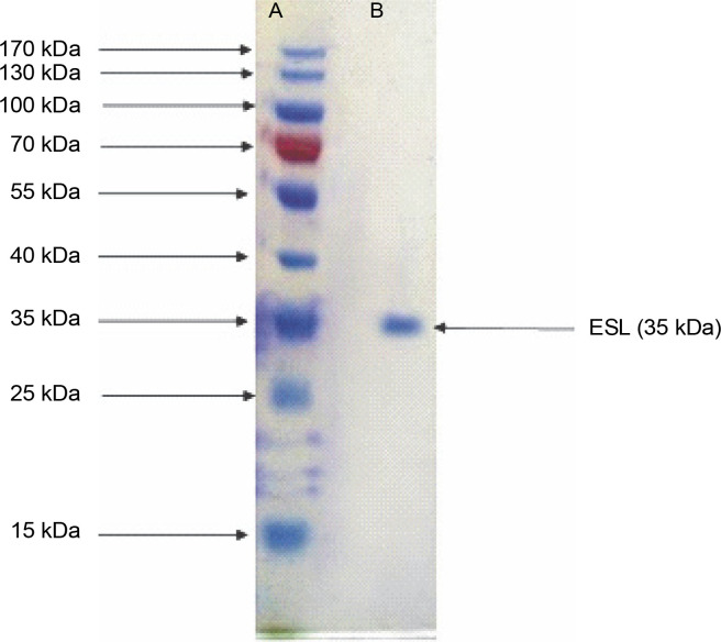 Antimicrobial activities and phylogenetic study of <i>Erythrina senegalensis</i> DC (Fabaceae) seed lectin.