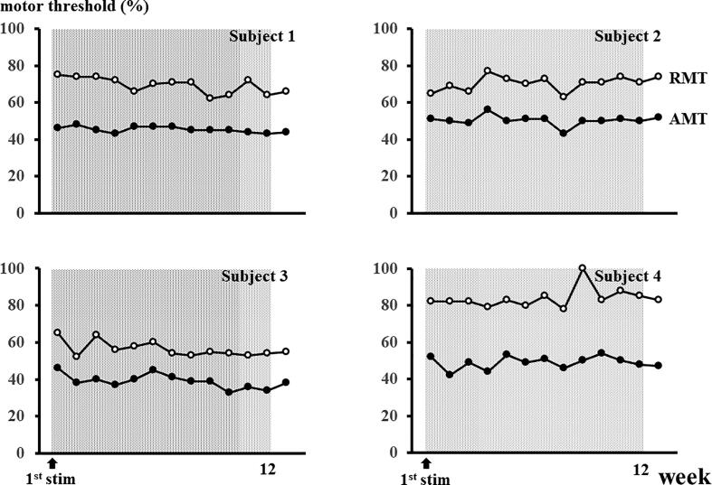 Quadripulse transcranial magnetic stimulation inducing long-term depression in healthy subjects may increase seizure risk in some patients with intractable epilepsy