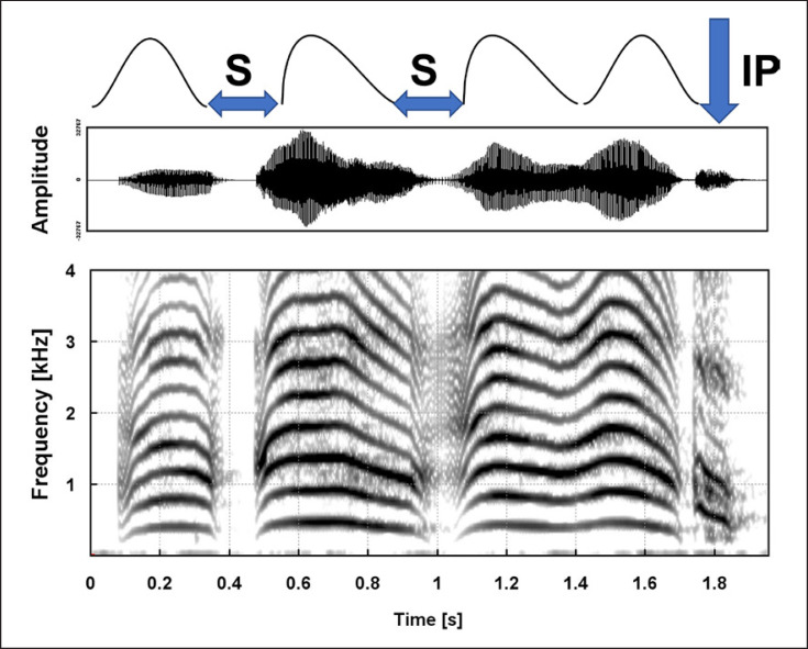 Fundamental Frequency Contour (Melody) of Infant Vocalizations across the First Year.